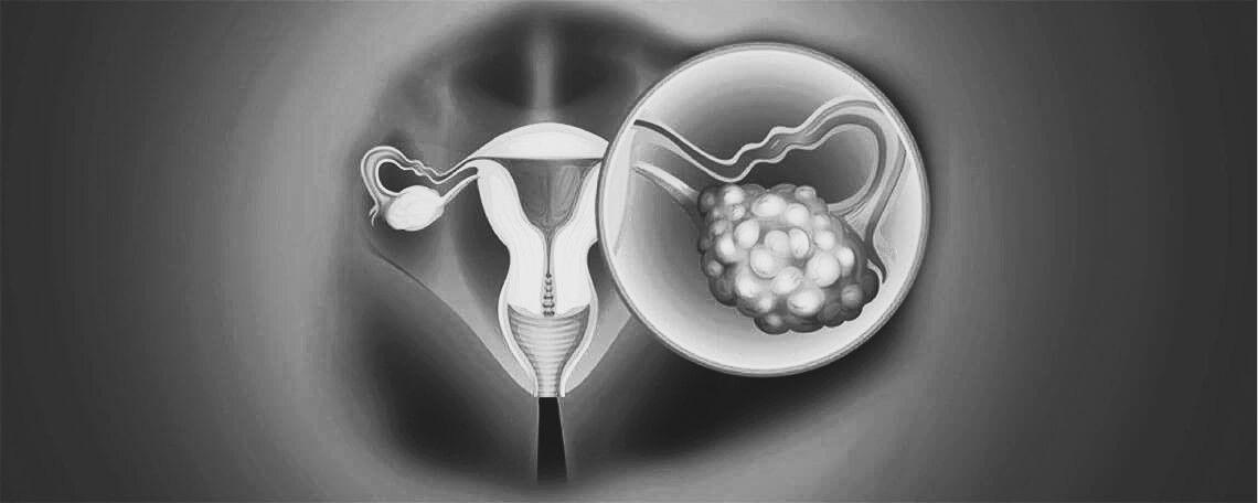 Default image description