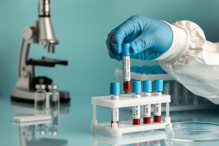 Gut Microbiome Test Measures